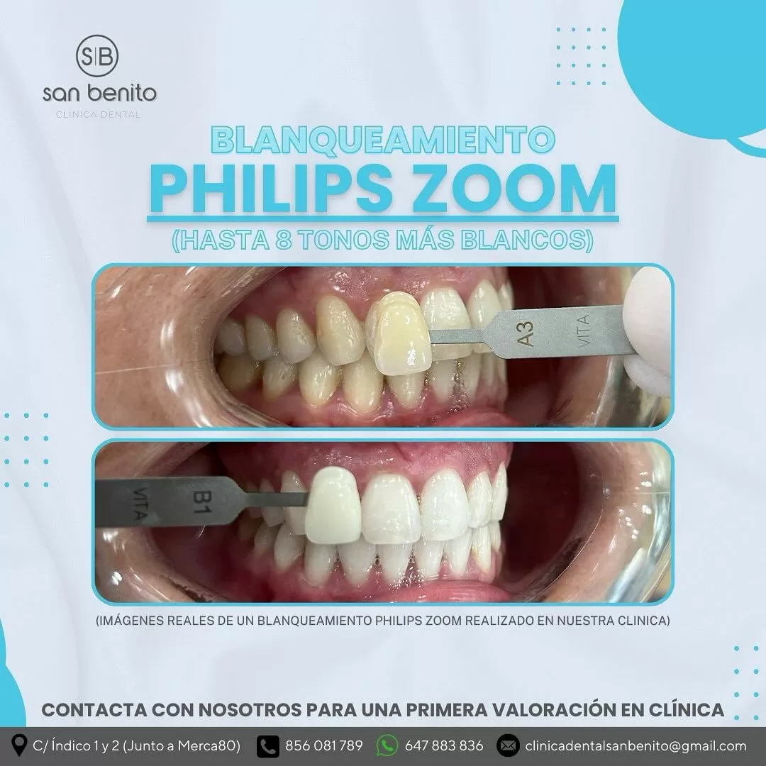 Almacén lleno de cajas con material